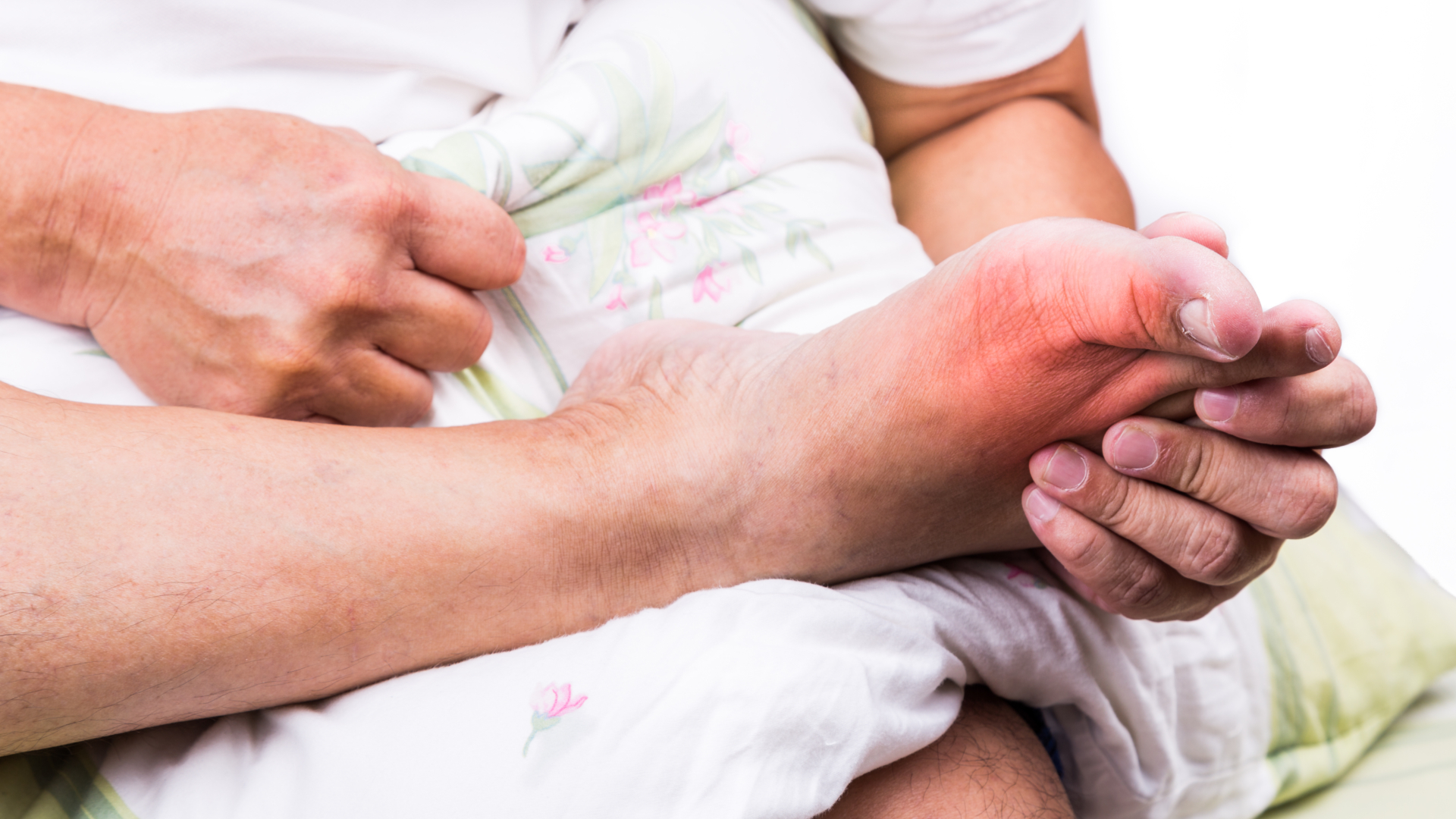 Gikt – en av de sämst behandlade sjukdomarna hos män över 70 år