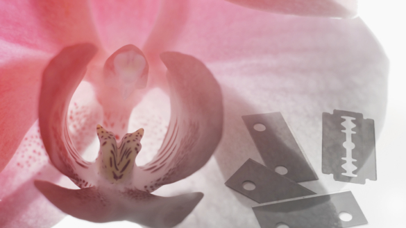 Kvinnlig könsstympning – ny kartläggning från Socialstyrelsen