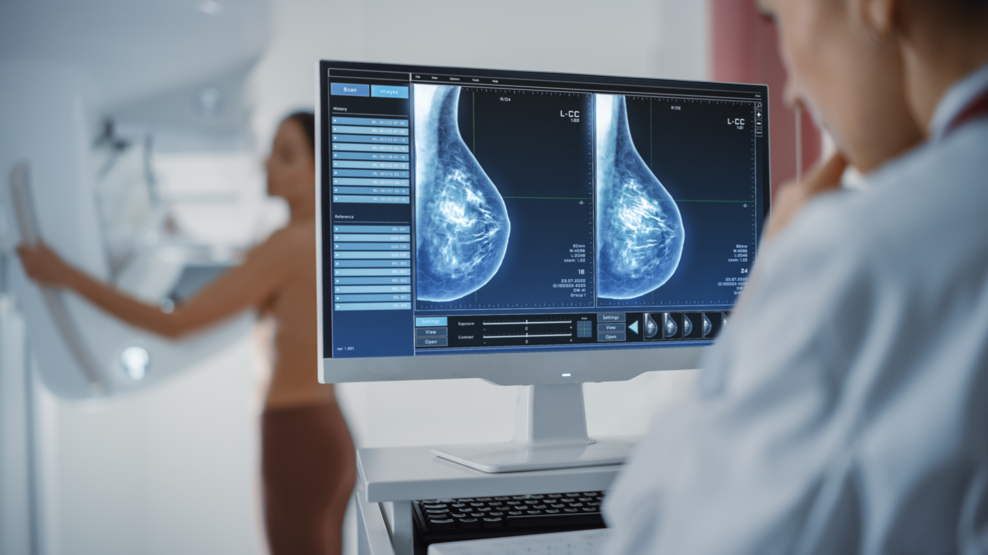 Utvärdering av screening för bröstcancer visar på minskad dödlighet men ojämlika förutsättningar