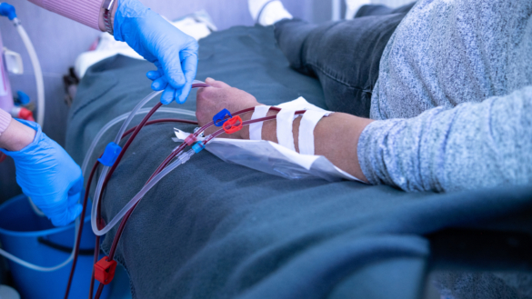 Stora hälsorisker med obehandlad kronisk njursjukdom