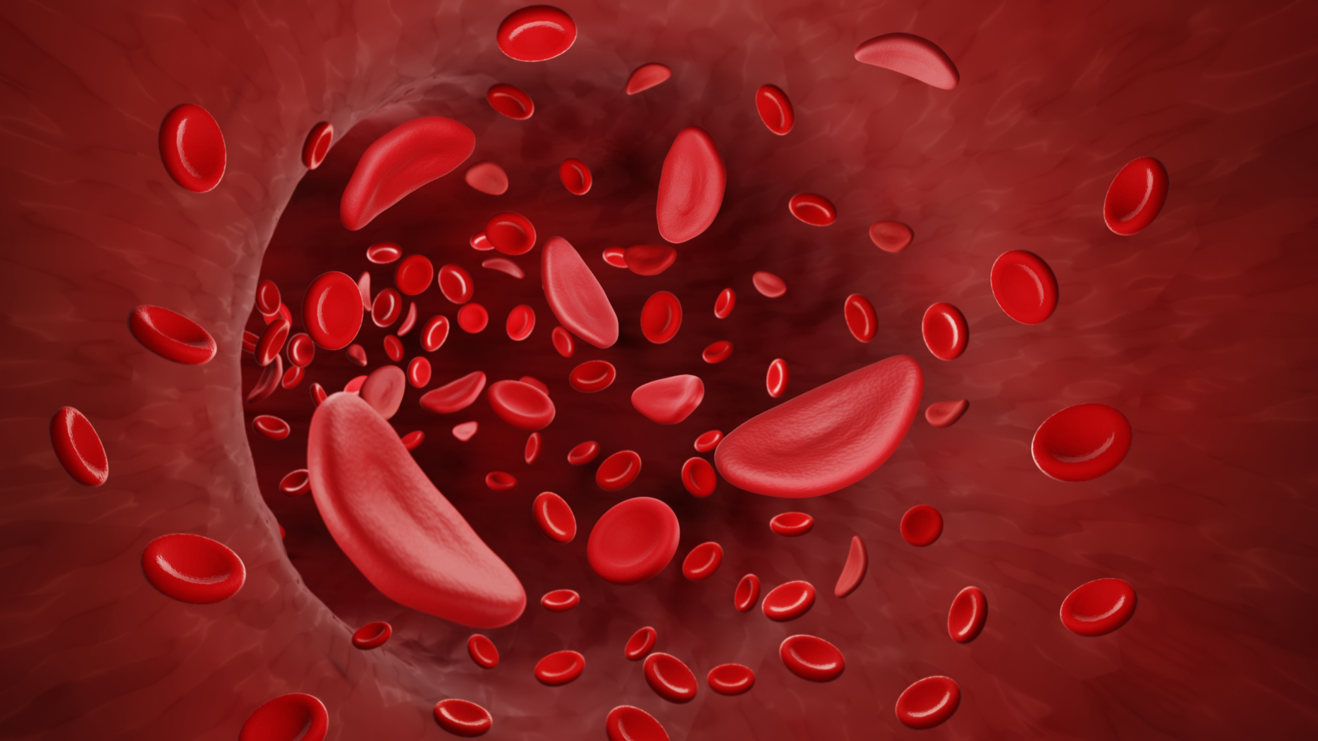 Hemoglobinopatier får eget nordiskt möte
