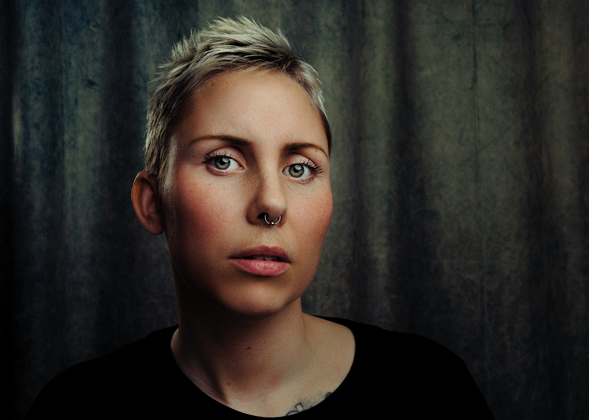 Migrän – Från misstanke till uppföljning